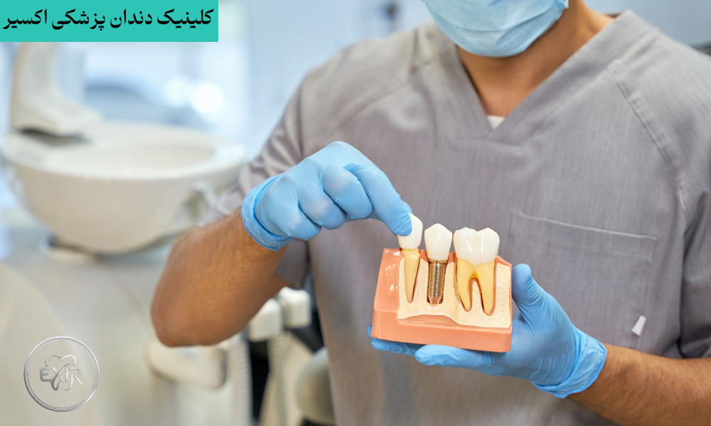 بررسی عکس سه بعدی فک CBCT برای ایمپلنت