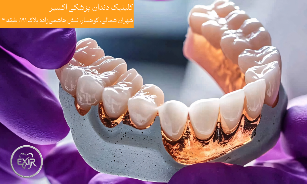 اهمیت کیفیت در ترمیم دندان