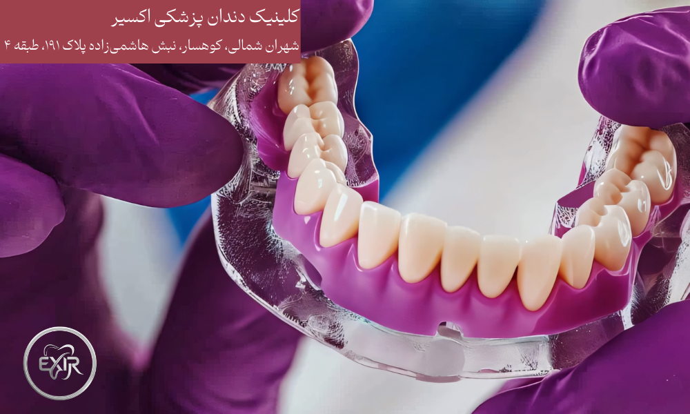 انواع پروتز کامل و پارسیل دندان