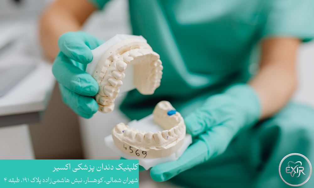مزایای استفاده از دندان مصنوعی