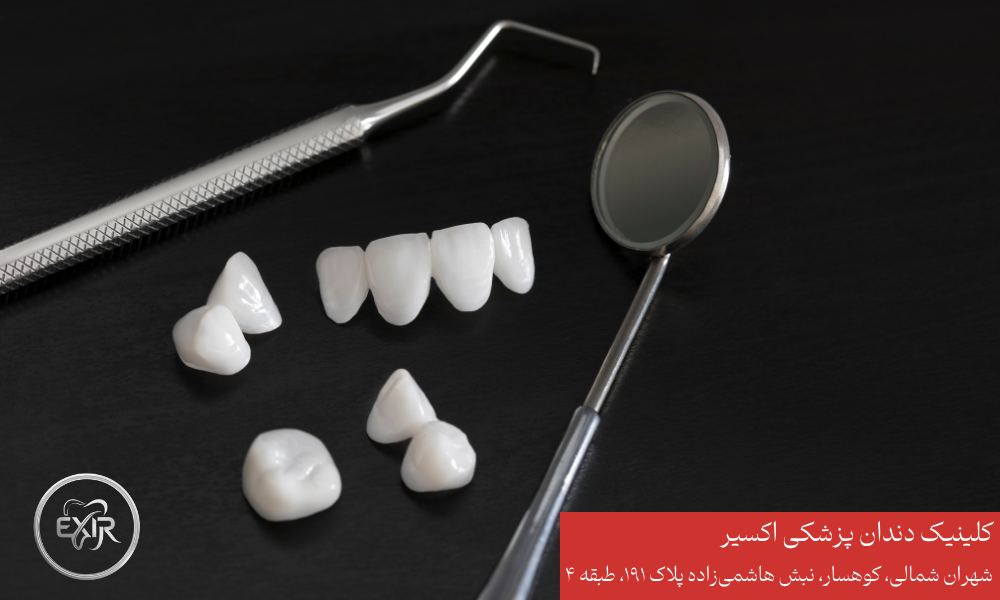 مراقبت و نگهداری از دندان مصنوعی