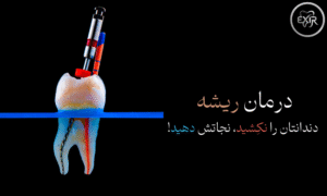 درمان ریشه در غرب تهران شهران