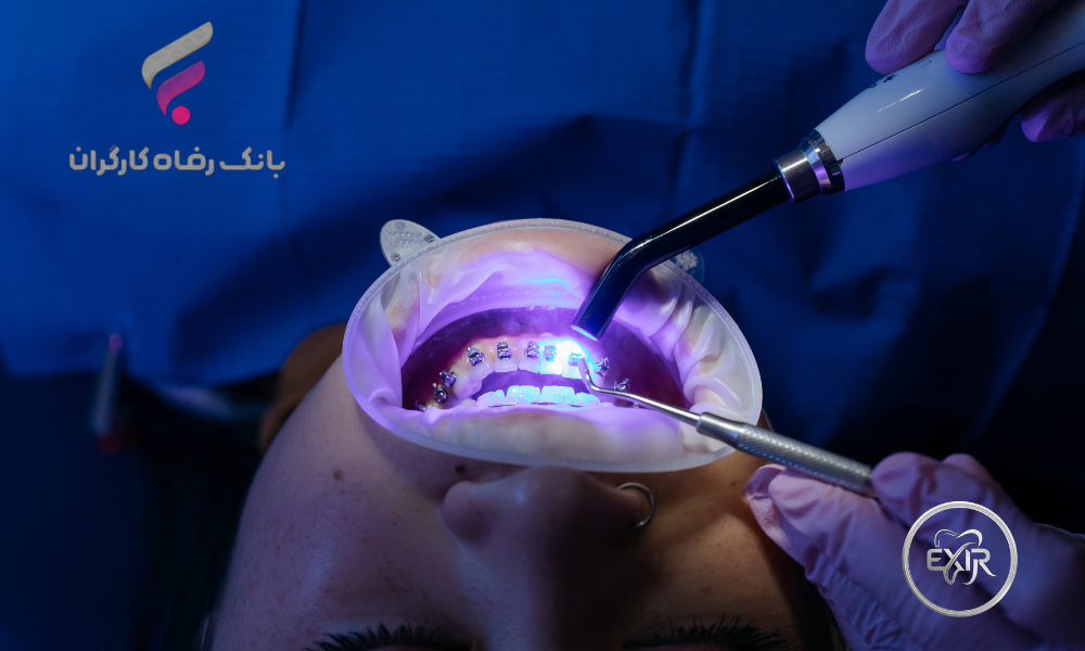 طرح اقساطی دندانپزشکی برای مستمری‌بگیران بانک رفاه