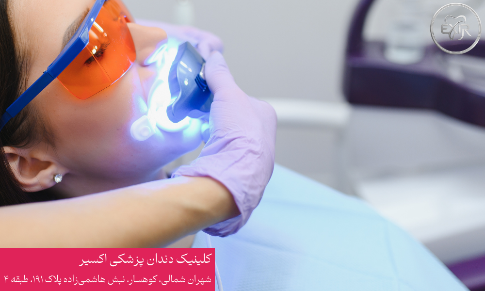 فرآیند بلیچینگ و سفید شدن دندان