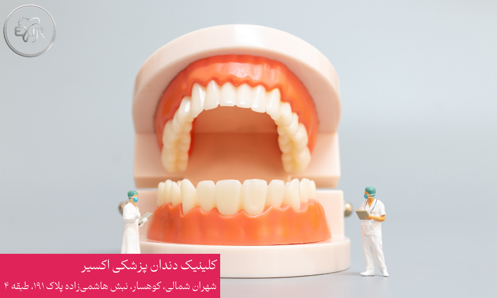 دلایل کشیدن دندان