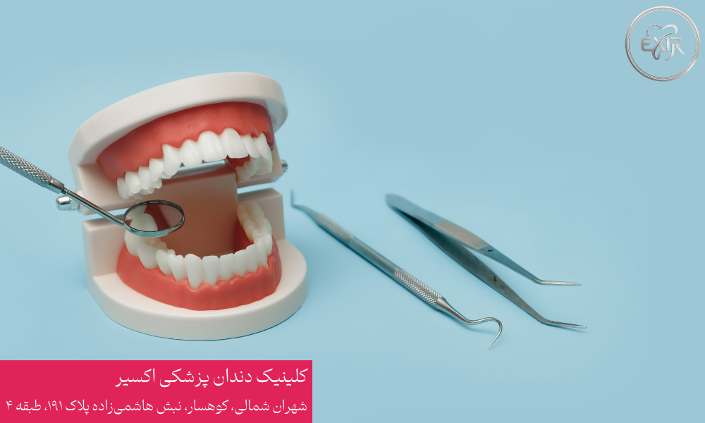 مراقبت بعد از کشیدن دندان
