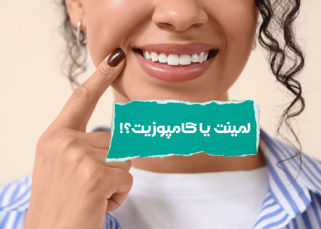 مقایسه ی لمینت دندان و کامپوزیت دندان