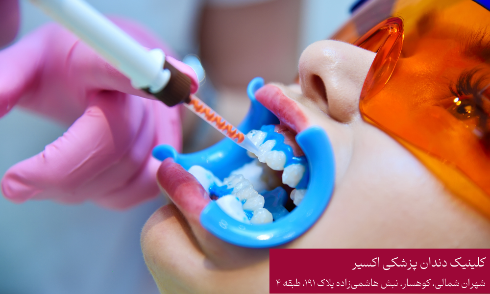 اهمیت دندان شیری در دندانپزشکی کودکان
