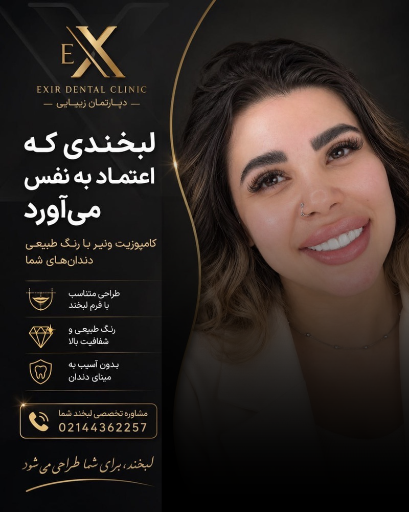 جشنواره کامپوزیت دندان