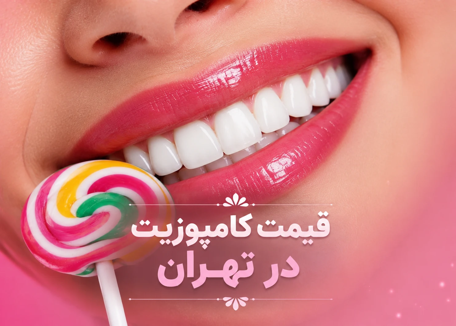 قیمت کامپوزیت در تهران