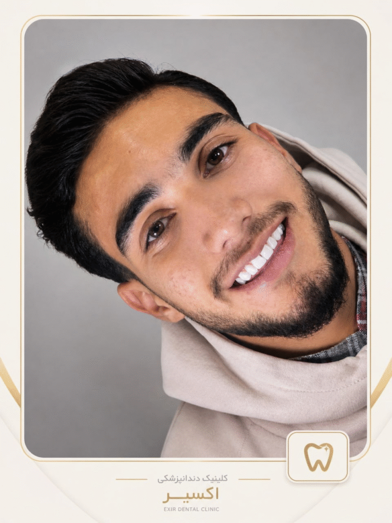 جشنواره کامپوزیت زیبایی 1