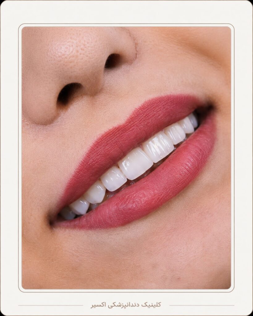 نمونه کار های واقعی اکسیر