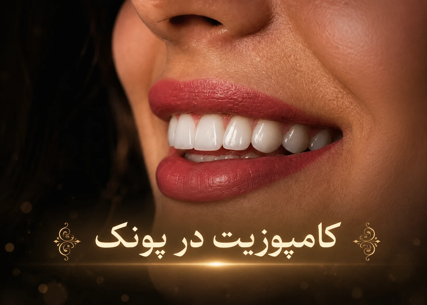 کامپوزیت در پونک - ما شهرانیم و نزدیک ما اند و می توانند به ما مراجعه کنند.