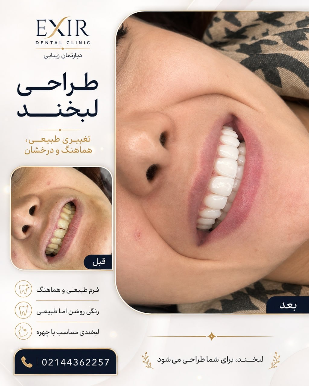 بهترین کلینیک کامپوزیت قسطی در تهران