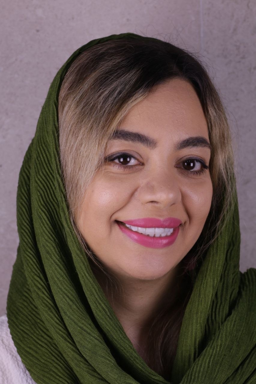 نمونه واقعی نتیجه کامپوزیت دندان در کلینیک اکسیر
